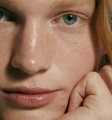 model with face on hand, close up of skin