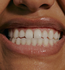 model baring teeth, wearing peptide lip treatment