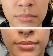 Top: Before Using Peptide Lip Treatment; Bottom: After Using Peptide Lip Treatment for 14 Days