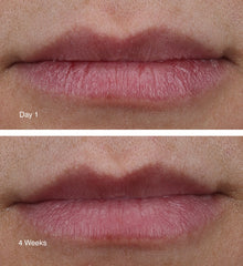 Before and after comparison of lips with 'Day 1' and '4 Weeks' labels after applying peptide lip treatment.