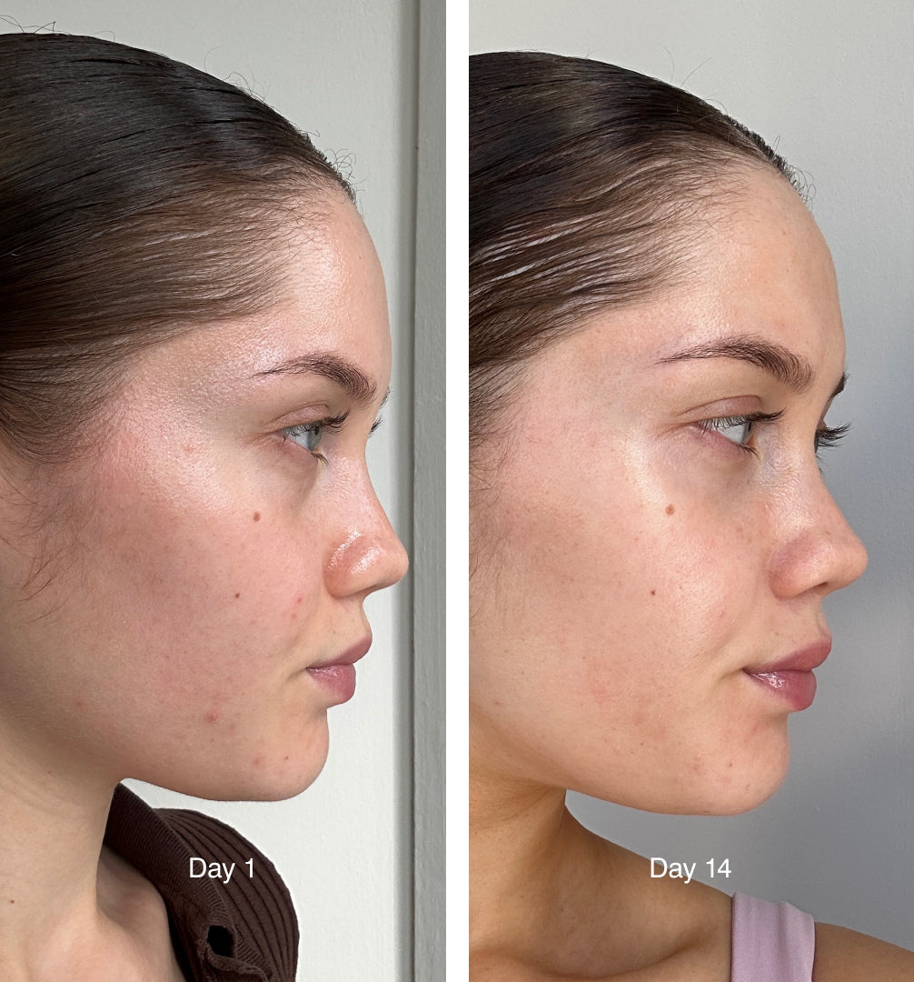 community results photo