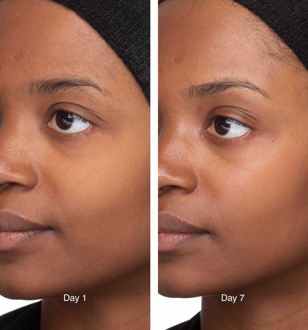 consumer results photo